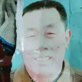 小脑萎缩最新研究成果揭秘，突破性的进展与发现