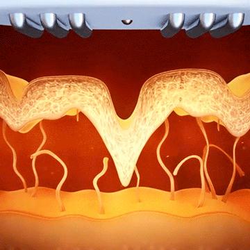 美容科技利器，最新仪器设备重塑美丽